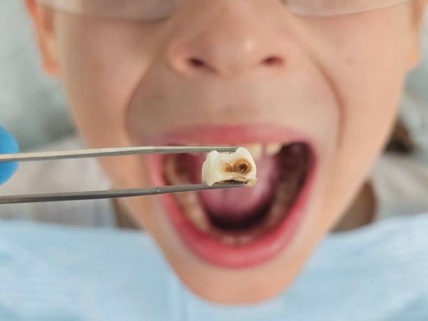 Best Pediatric Emergency Dentist in Poway, CA
